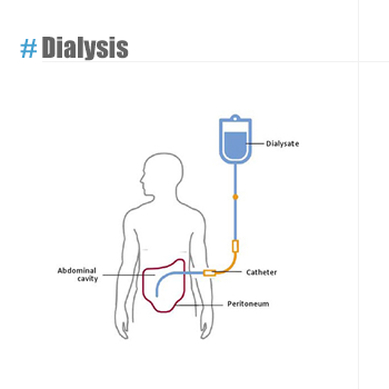 Dialysis