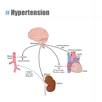Hypertension