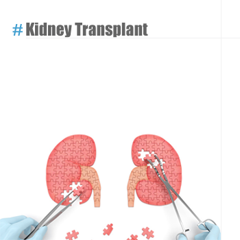 Kidney Transplant