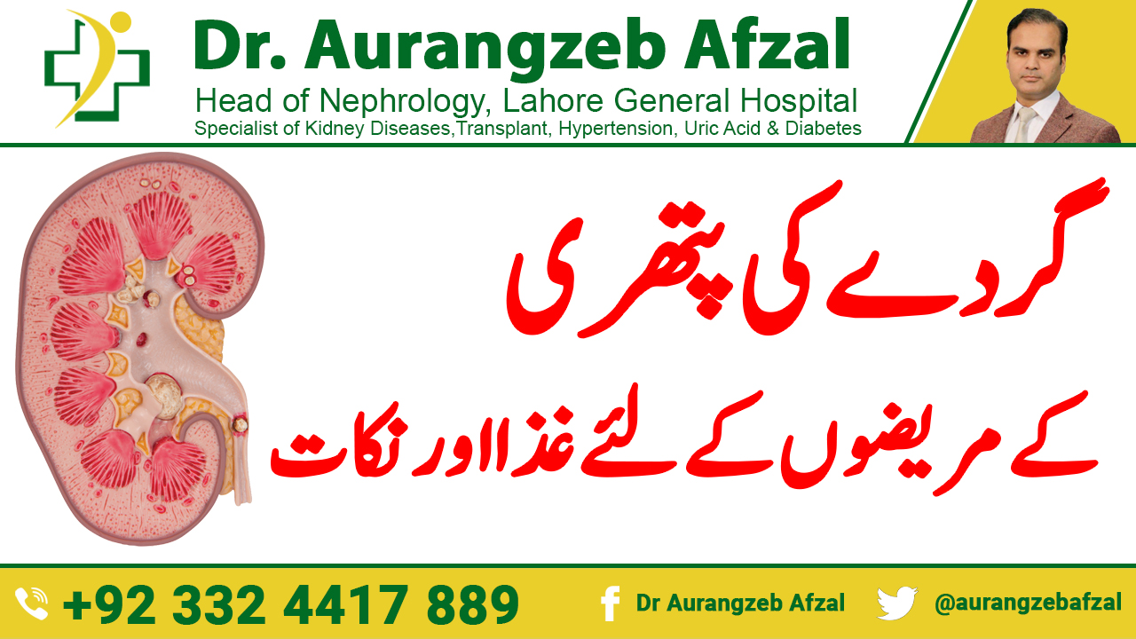 Diet for Kidney Stones Patients - What to Eat & Avoid - Diet Tips to prevent kidney stones