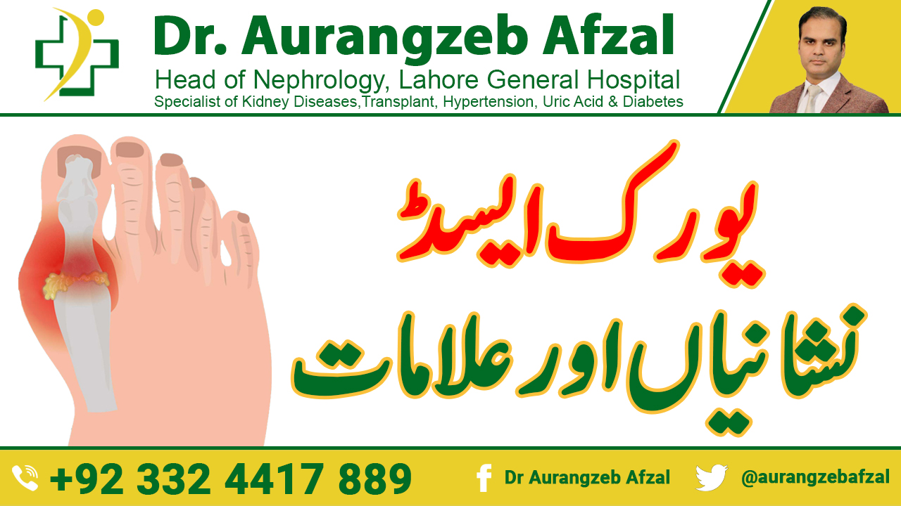 What are the Sign & symptom of Uric Acid in Urdu/Hindi