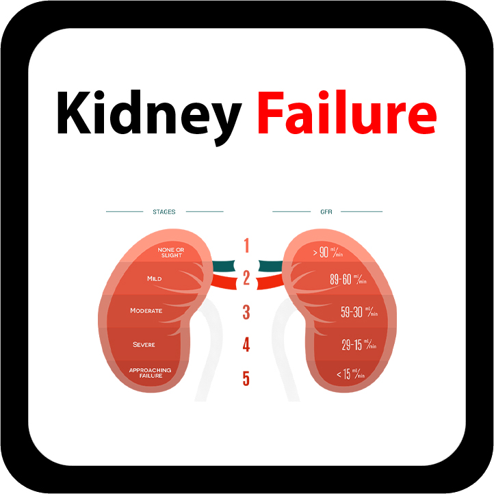 Kidney Failure
