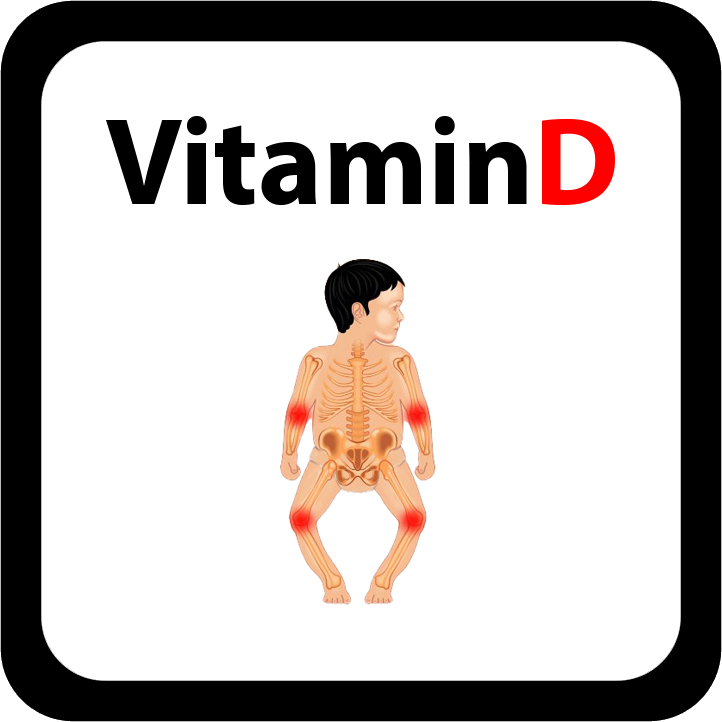 VitaminD