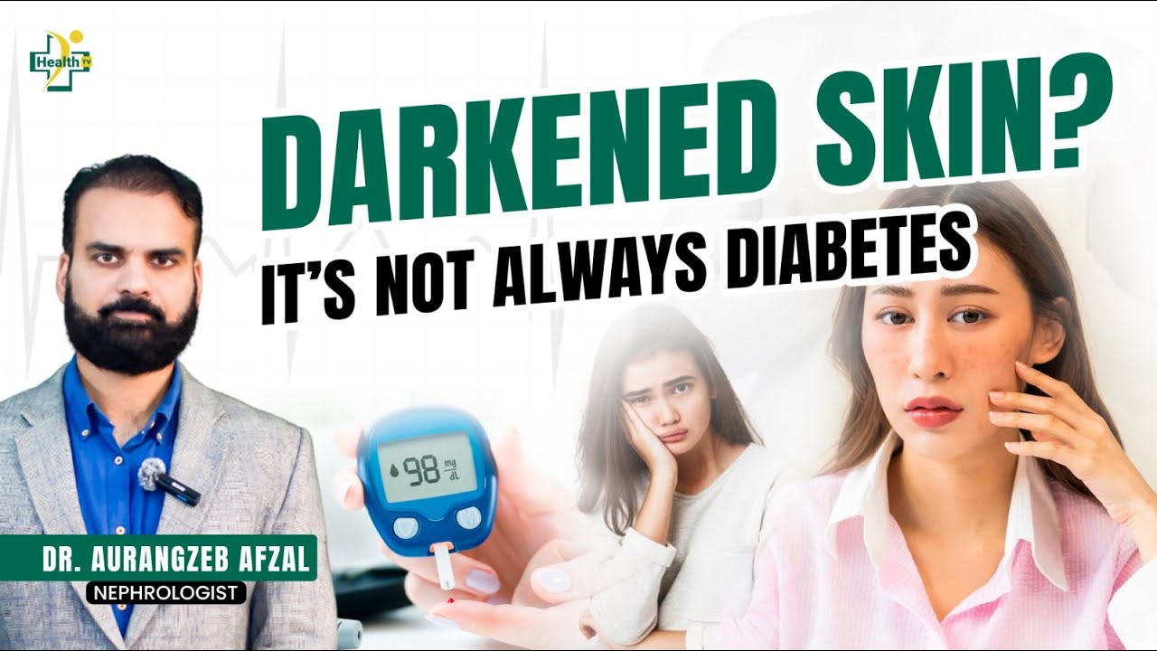 Skin Darkening: It's Not Just Diabetes! What's the Real Cause?