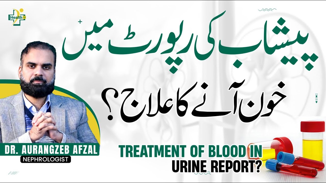 Peshab Ki Report Mein Khoon Ka Ana Wajuhat Aur Ilaj | Blood In Urine Treatment | Hematuria Treatment