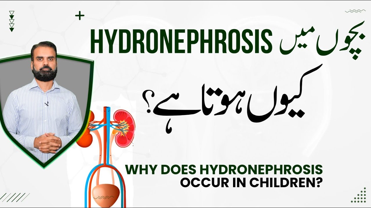 Bachon Mein Hydronephrosis Kyun Hota Hai? | Causes & Treatment of Hydronephrosis in Children