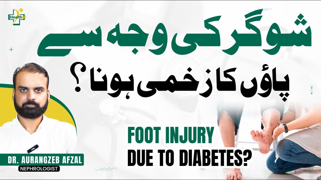 Sugar Ke Zakham Ka Ilaj | How To Treat Diabetes? | Diabetic Foot Causes & Treatment in Urdu