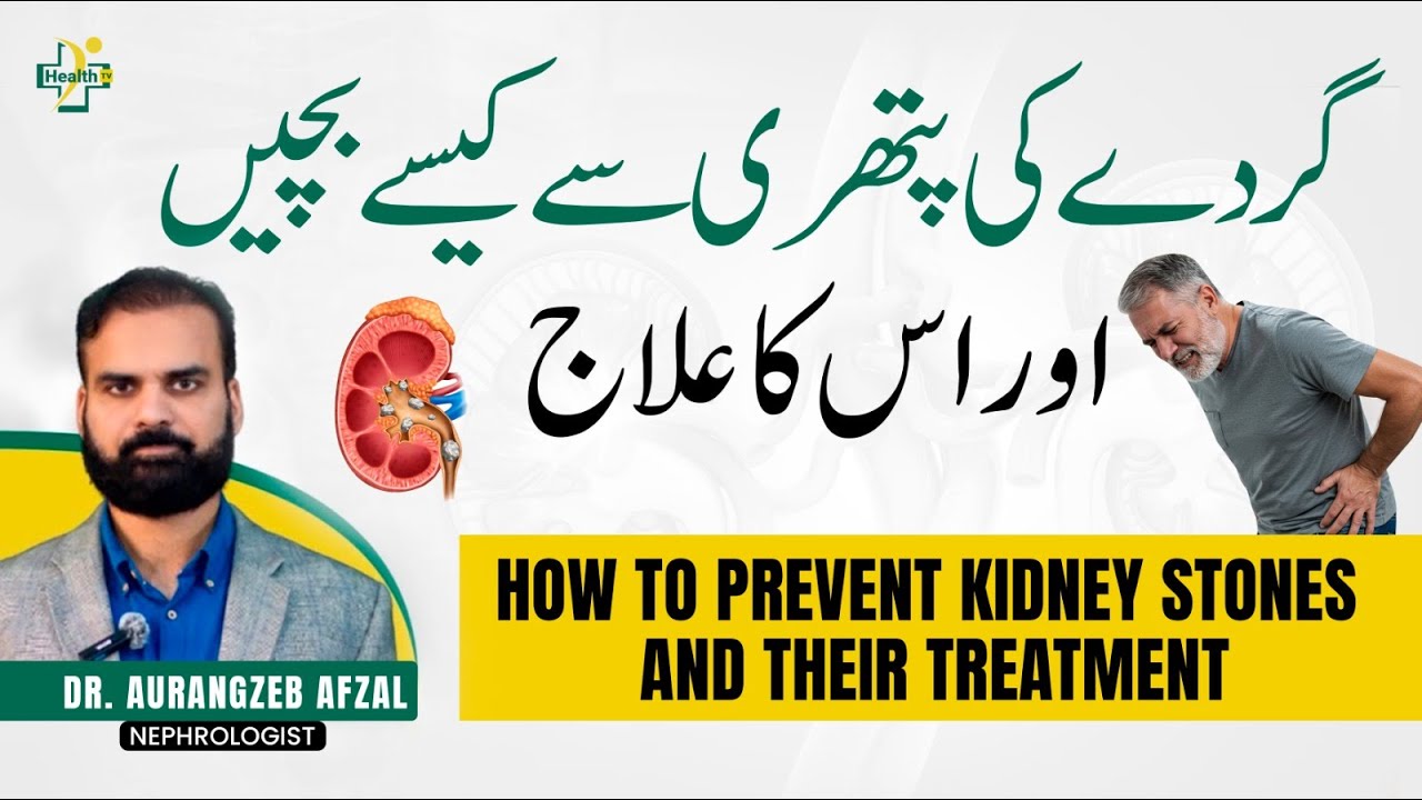 Gurday Ki Pathri Ka Asaan Ilaaj | Kidney Stone Treatment Tips | Urdu | Hindi