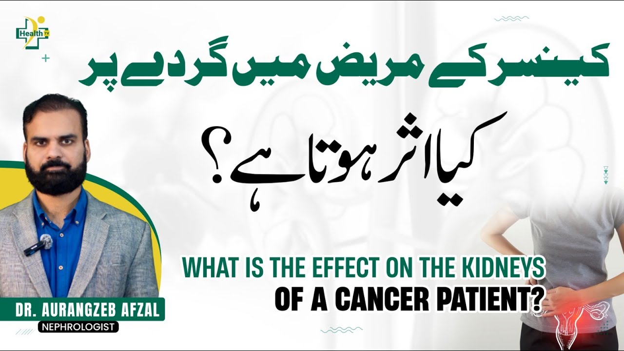 Cancer Ki Wajah Sy Gurdy Ki Kharabi Ka Hone | Kidney Cancer Causes & Treatment | Kidney Problem
