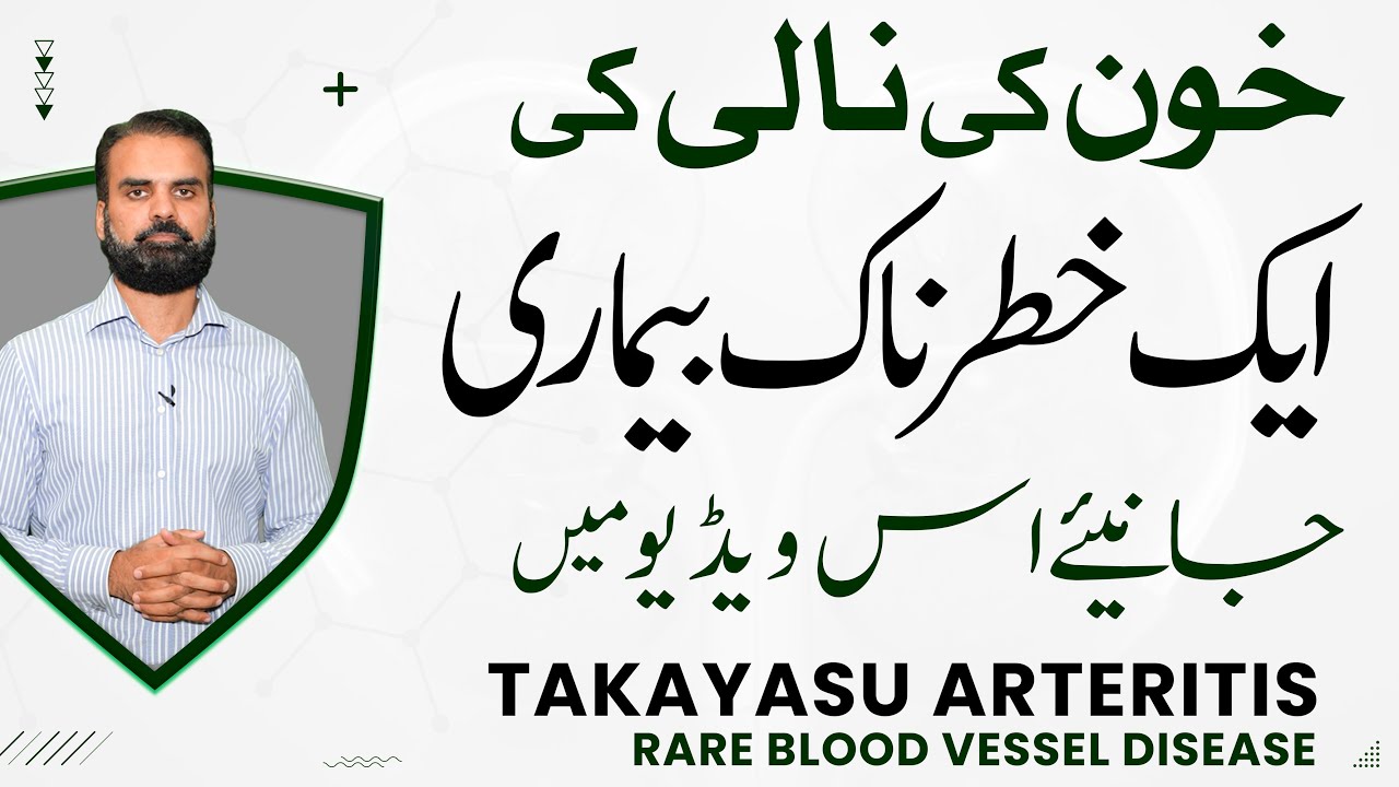 Dont Ignore Blood Pressure: Takayasu Arteritis - Aik Khatranak Bemari