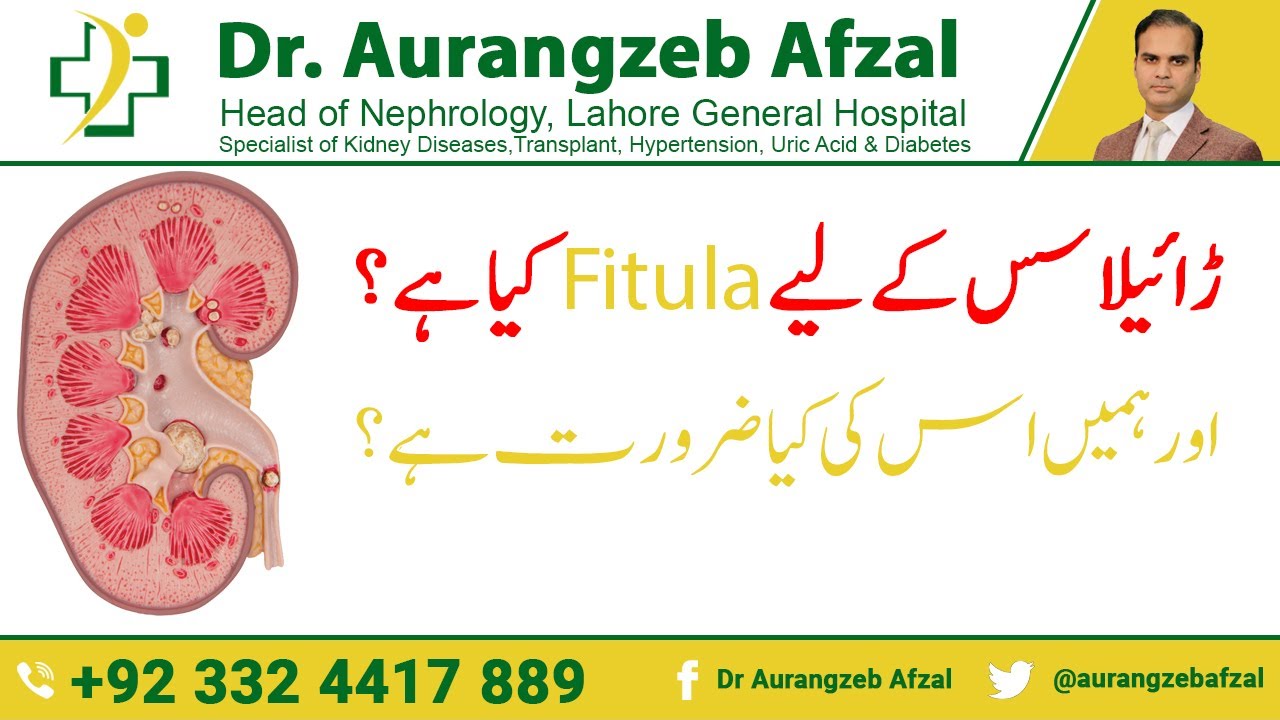 Dialysis | Fistula | What is Fistula for Dialysis | Why do we need Fistula for Dialysis - Urdu/Hindi