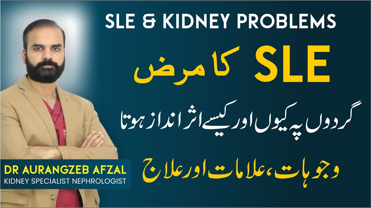 SLE Disease: Side Effect on Kidney | Symptoms & Treatment Guide in Urdu | SLE & Kidney
