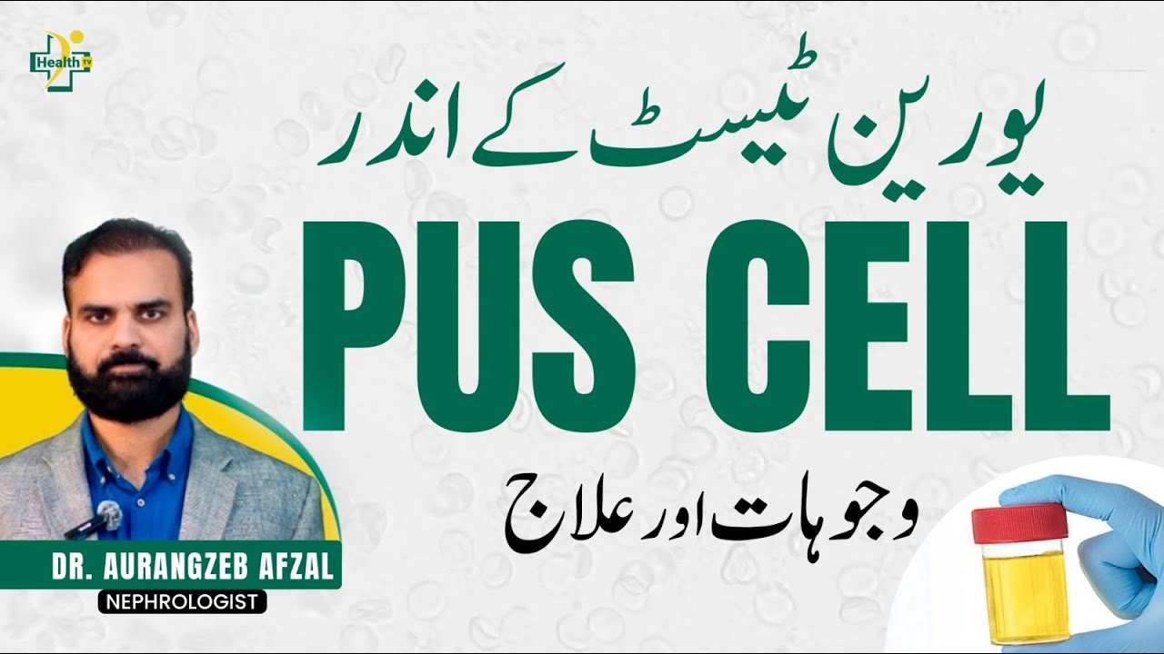 Pus Cells in Urine - Wajuhat Aur Ilaaj | Peshab Mein Pus Cells Ka Aana