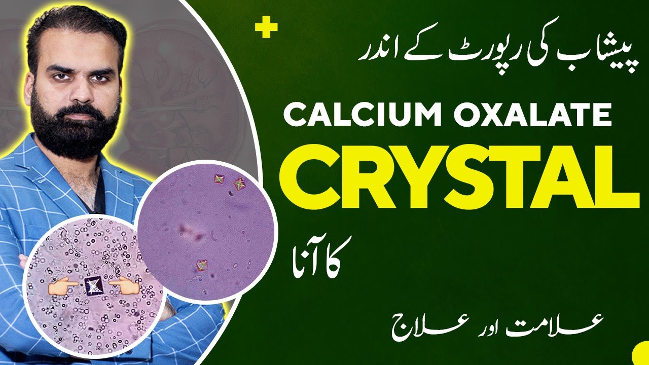 Crystal In Urine Test Causes & Treatment in Urdu | Peshab Mein Crystal