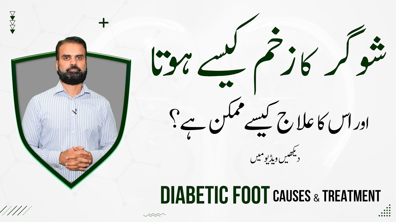 Sugar Ka Zakham Kyn Hota Aur Iska Ilaj | Sugar Diabetic Foot Causes & Treatment in Urdu