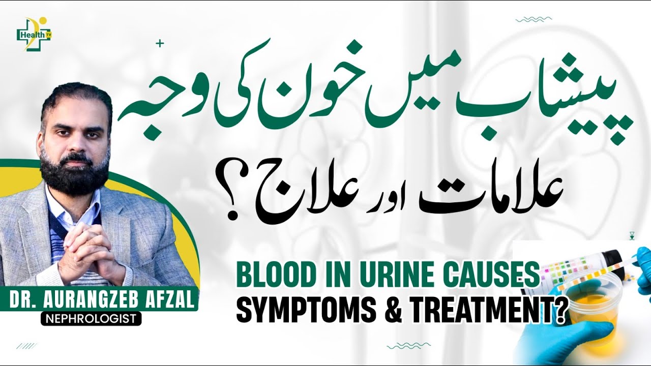 Peshab Mein Khoon Aane Ki Wajuhat Aur Ilaj | Blood In Urine Causes & Treatment in Urdu/Hindi