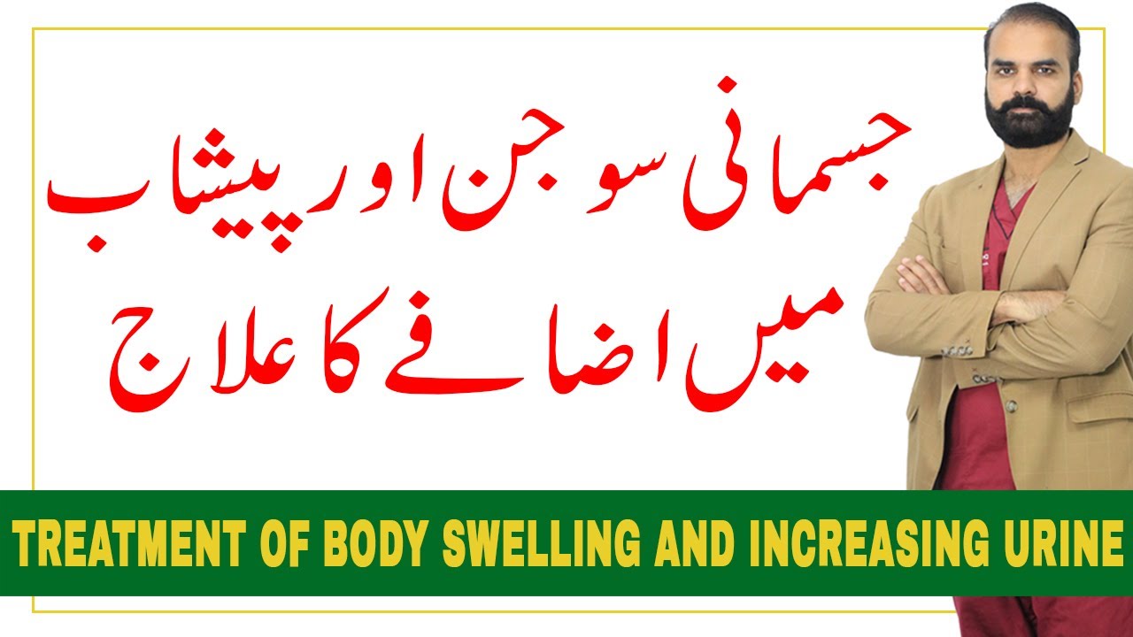 Treatment of Body Swelling and increasing urine ?Edema in Urdu Hindi?