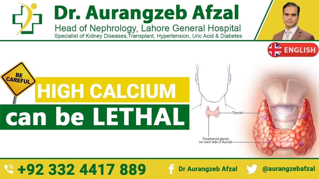 Hypercalcemia Symptoms, Treatment, Causes & Definition [English]