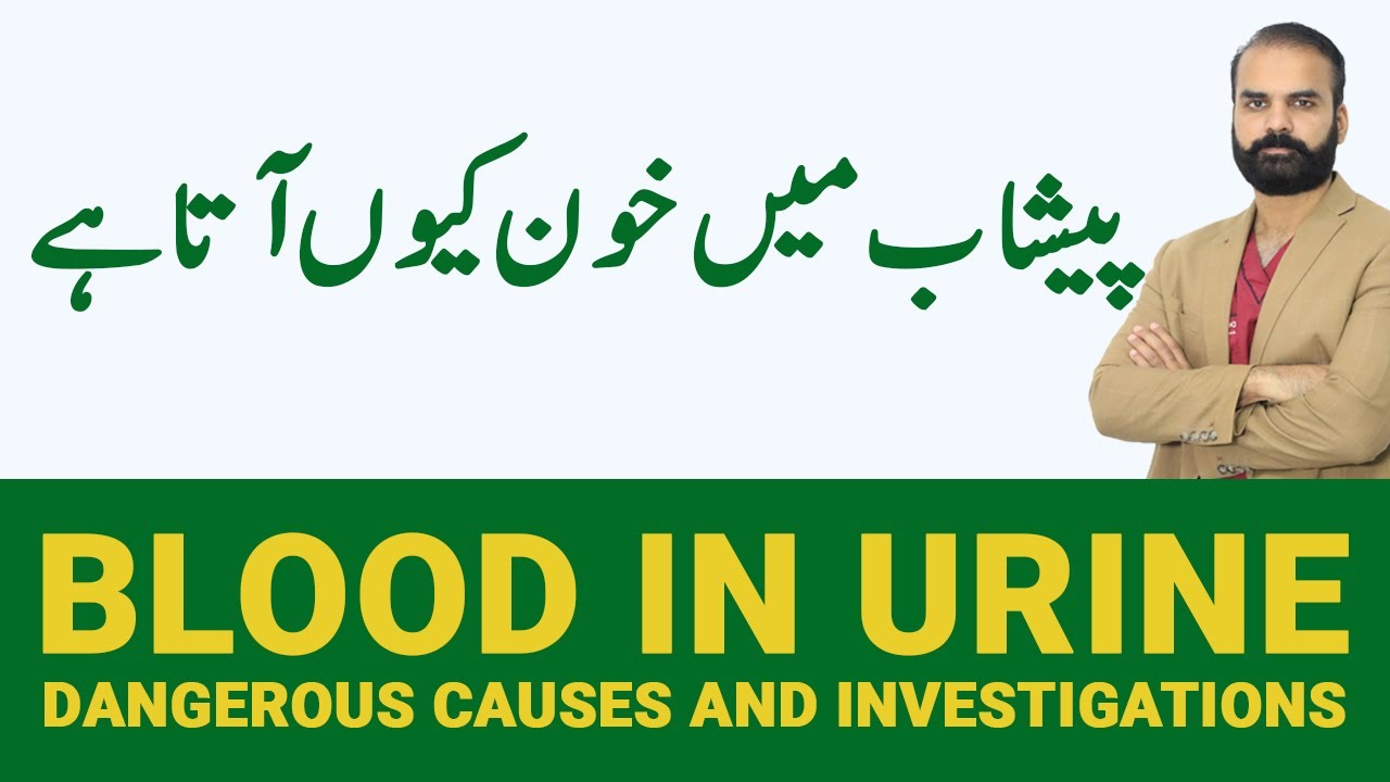 BLOOD in Urine | Peshab Mein Khoon Aane Ki Wajah in Urdu/Hindi
