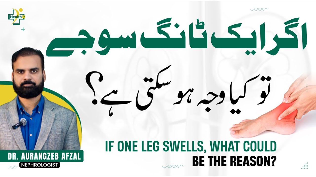 What are the Causes of Swollen Leg? | Tangon ky Sooj Jana ki Wajuhat & Ilaj | Swollen Leg Treatment