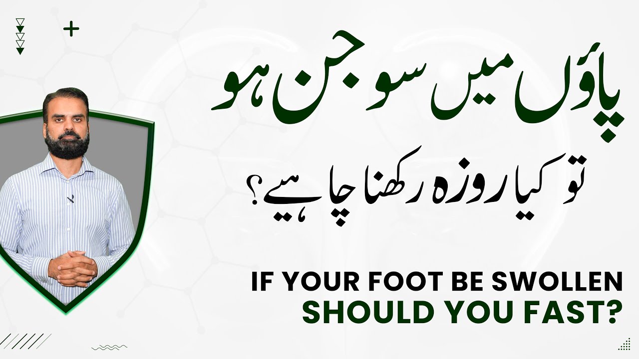 Ramzan Fasting With Swelling in Body or Foot Swelling