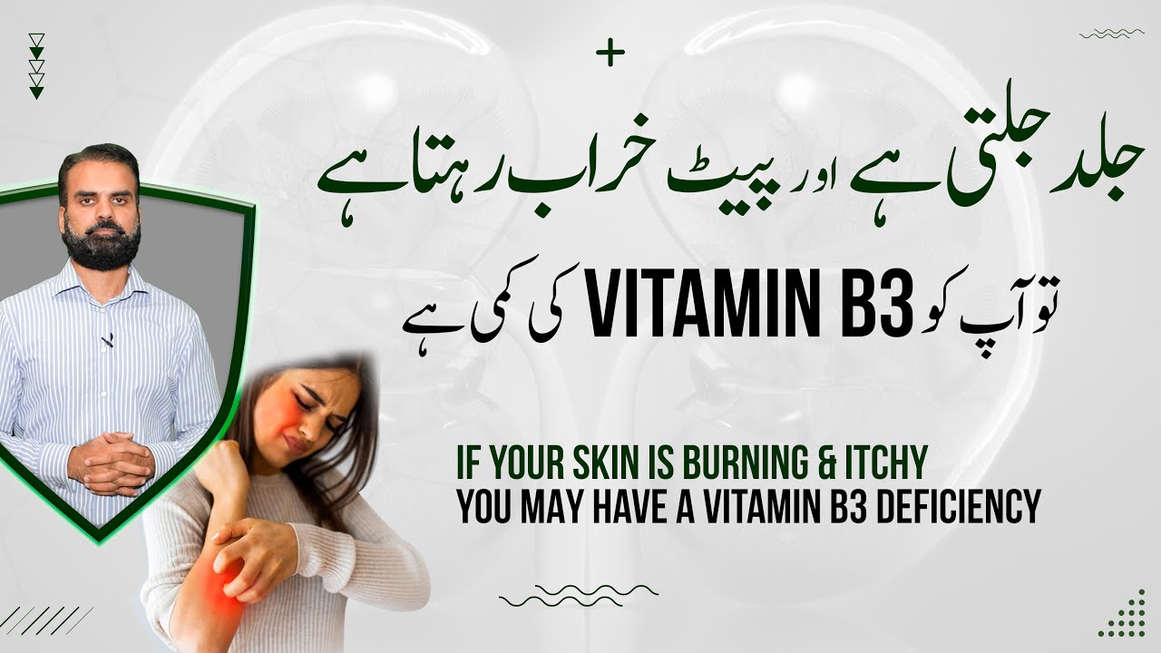 Vitamin B3 Deficiency Causes & Treatment in Urdu | Vitamin B3 Ki Kami Ki Alamat