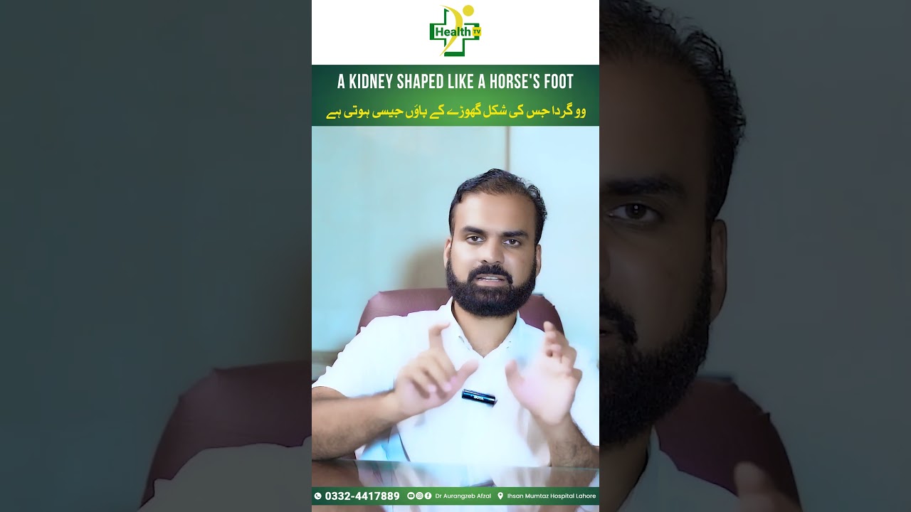 Gurda Jis Ki Shakal Ghode Ky Paon Jasi Hoti Hai | Horse Shoe Kidney Reasons & Treatment