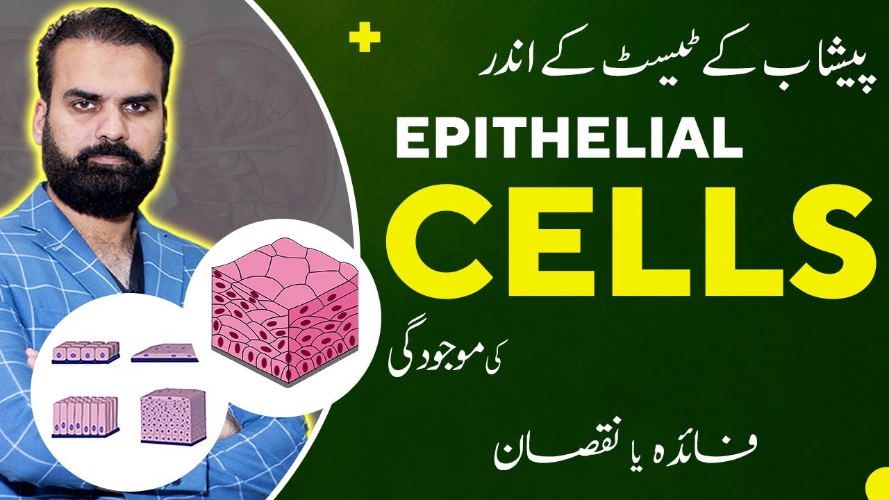 Epithelial Cells in Urine In Urdu | Causes, Treatment & Normal Range