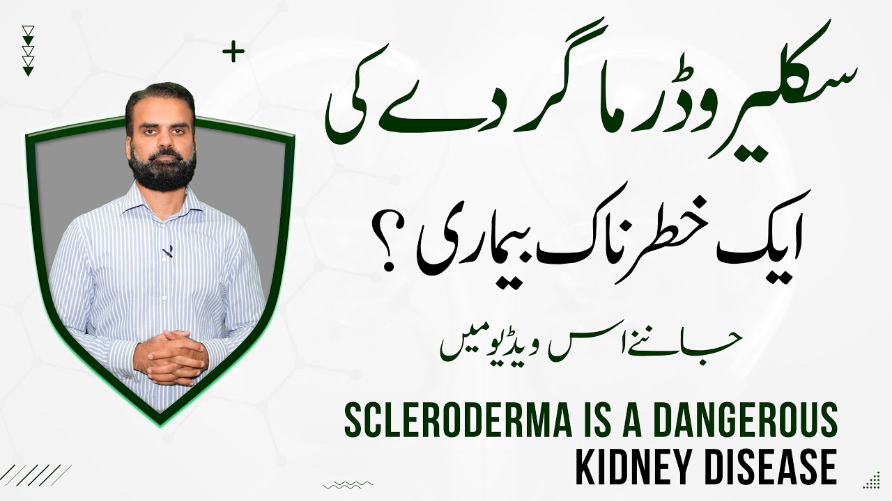 Kidney Most Dangerous Disease | Symptoms & Treatment Scleroderma in Urdu