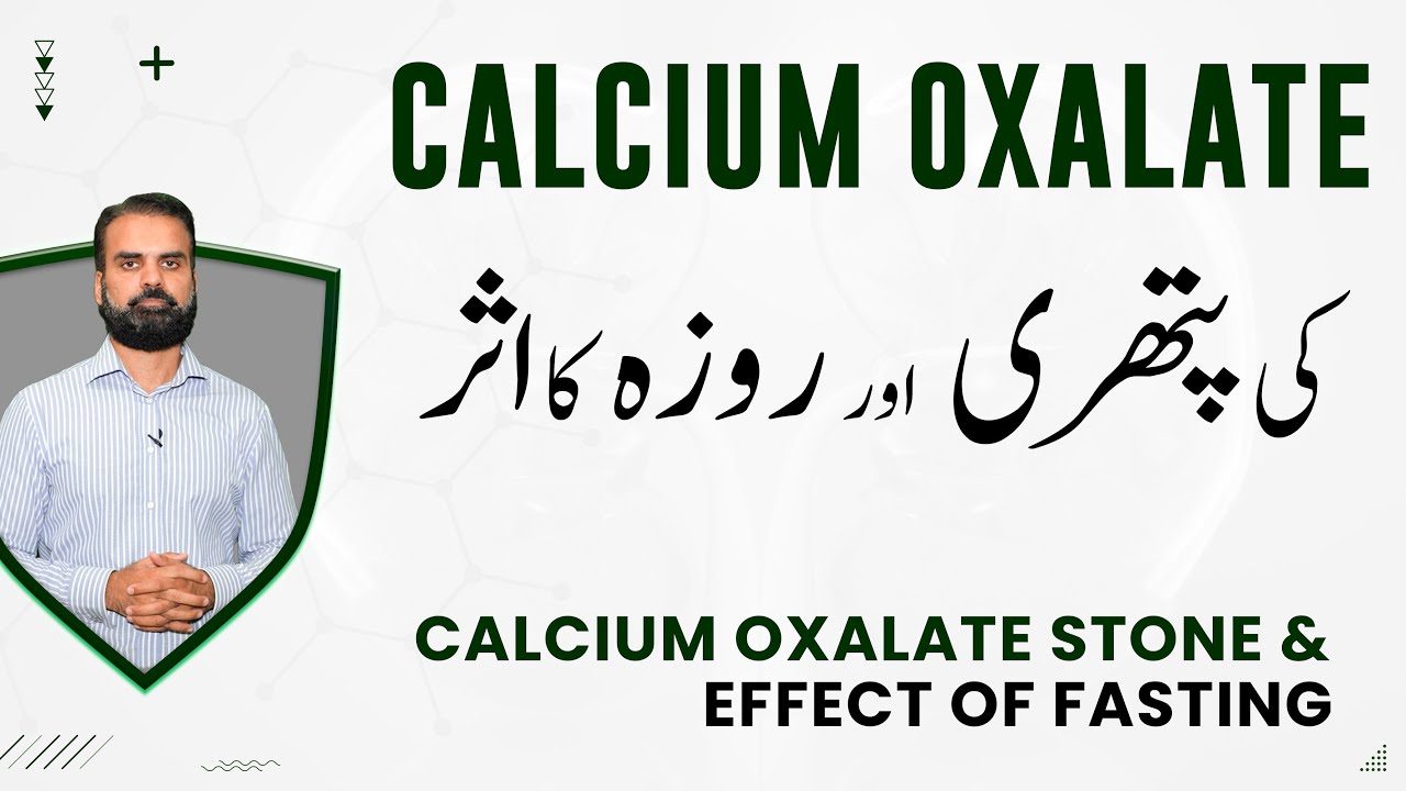 Kidney Stone Effects in Ramzan Fasting by Dr Aurangzeb Afzal