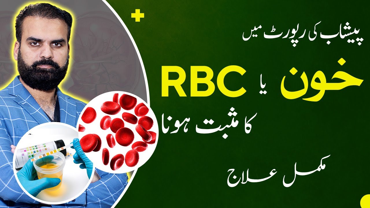 Blood in Urine or High RBCs in Urine Test Causes Symptoms & Treatment