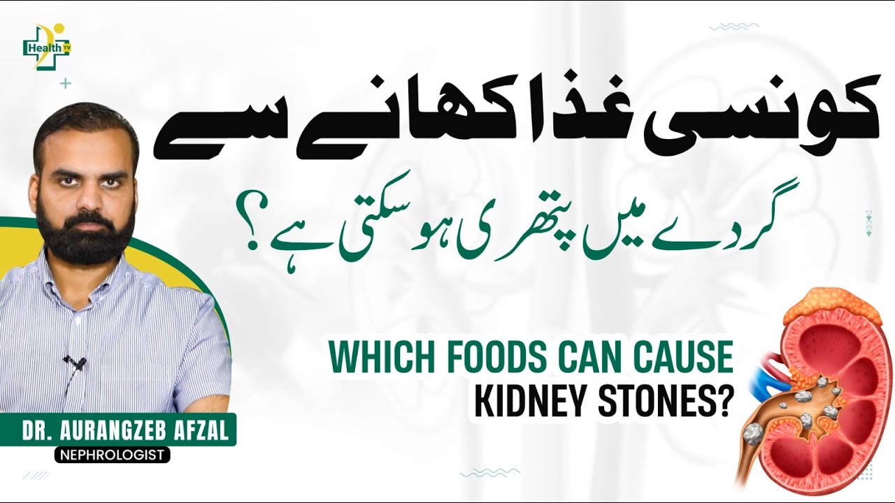 Konsi Giza Khane Se Gurde Mein Pathri Ho Sakti Hai? | Which Foods Can Cause Kidney Stones? In Urdu