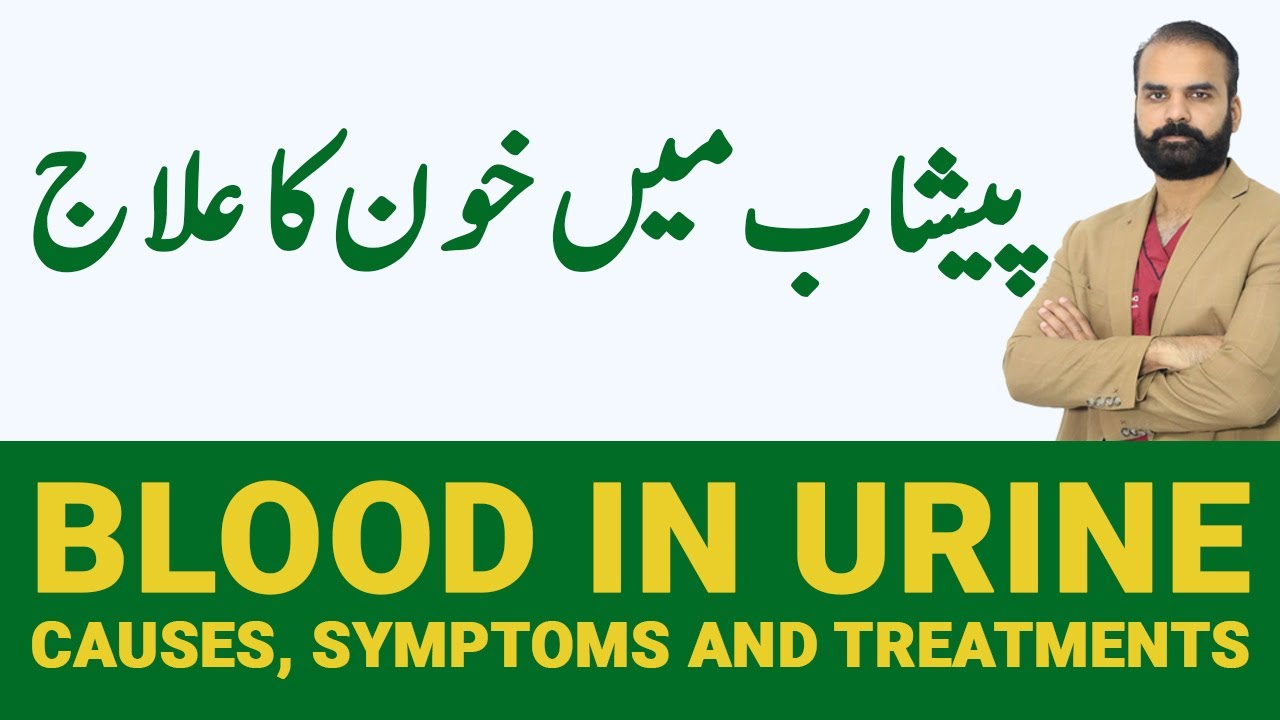 Blood in Urine - Causes, Symptoms and Treatments | Peshab Mein Khoon Aane Ka Ilaj [Urdu/Hindi]