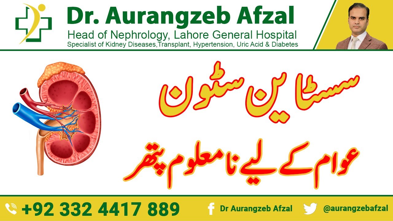 Cystine Kidney Stone | Kidney Stone | Dangerous unknown stone in Kidney [Urdu/Hindi]