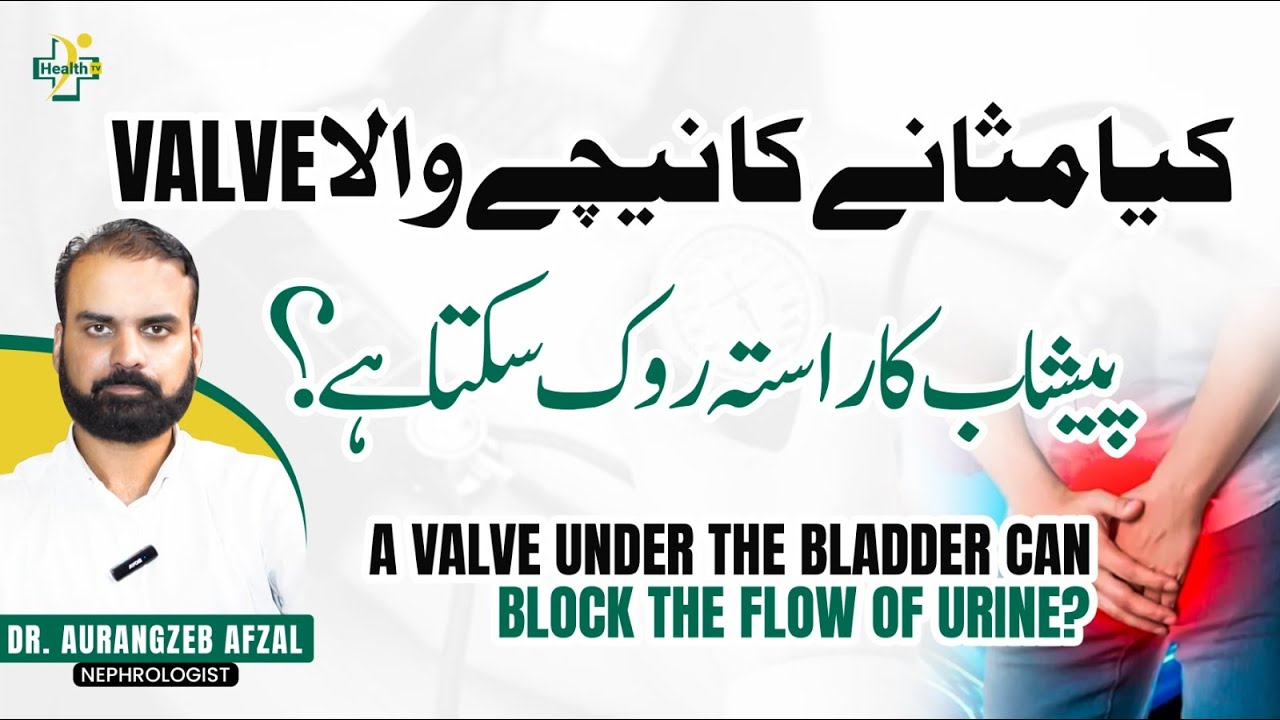 What is Posterior Urethral Valve? | Urinary Valve Problem | Peshab Mein Rukawat Ki Wajuhat Aur Ilaj