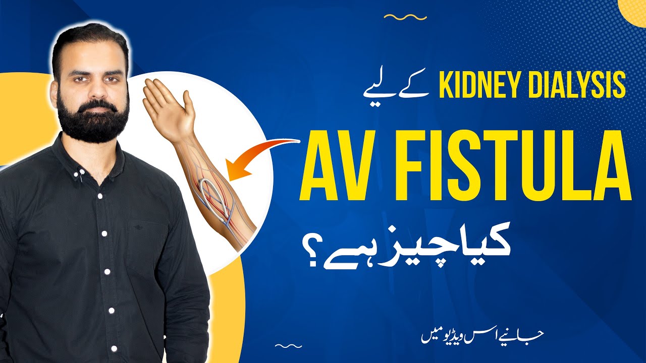 When You Need Kidney Dialysis AV Fistula | Dialysis Care Tips in Urdu