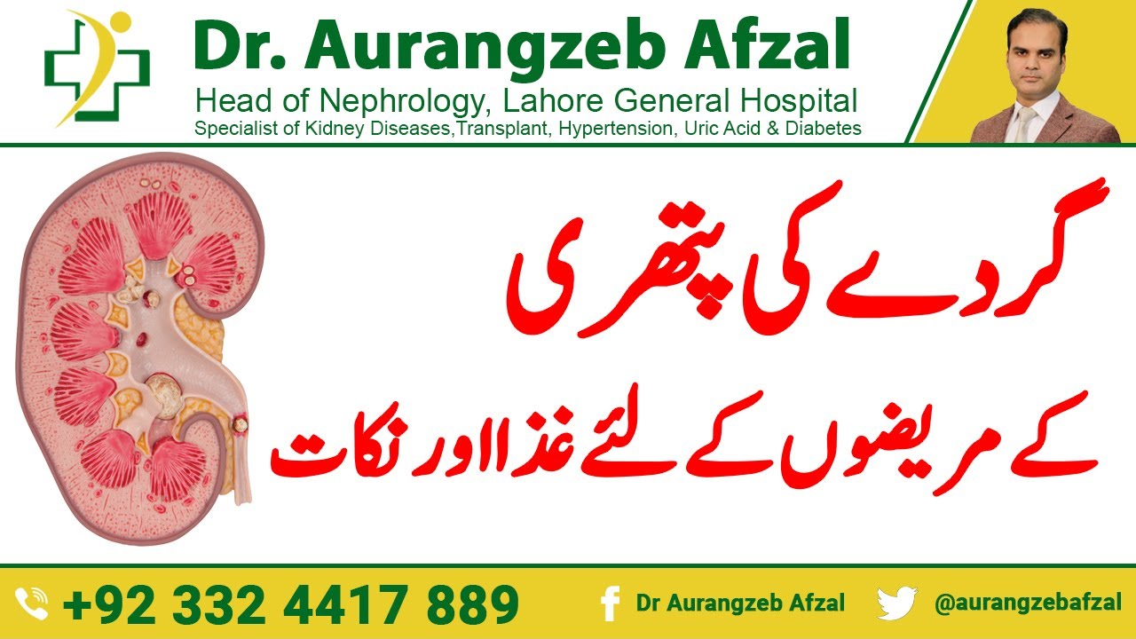 Diet for Kidney Stones Patients - What to Eat & Avoid - Diet Tips to prevent kidney stones