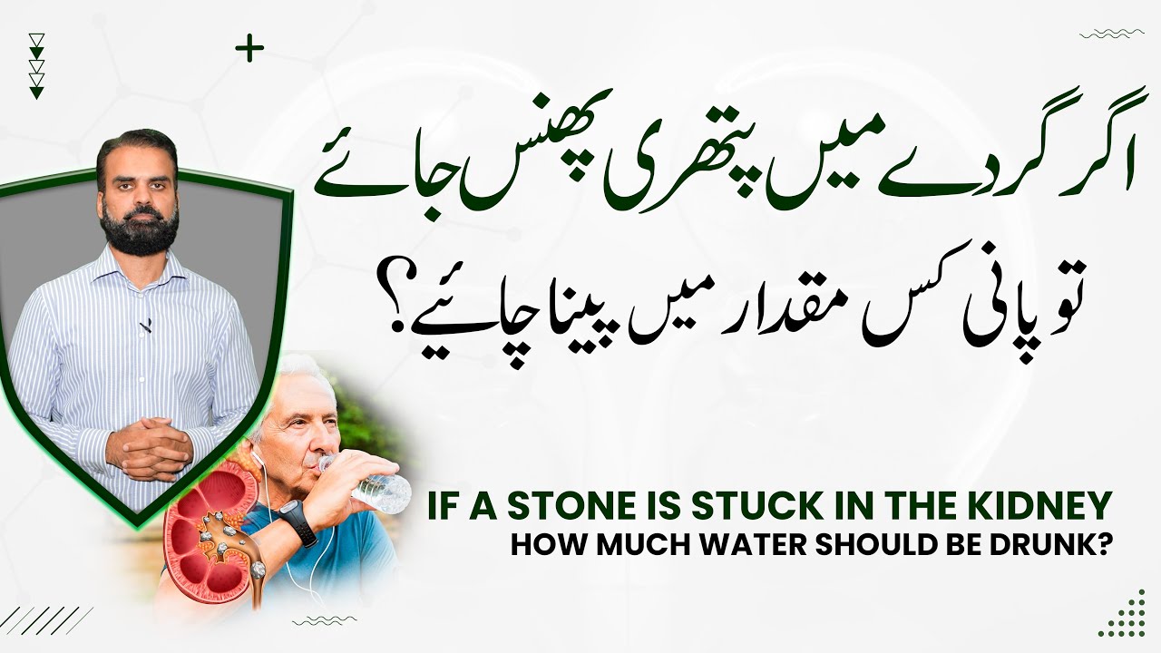 Gurday Mein Pathri Ke Phanss Jana Ka Ilaj | Kidney Stone Causes & Treatment in Urdu/Hindi