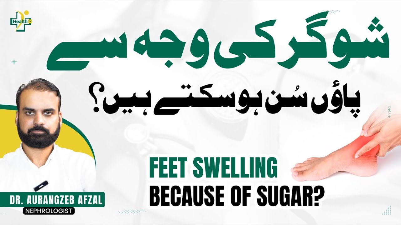 Sugar Ki wajah Se Paon Ka Sun Hona | Paon Ka Sun Hojana | Numbness In Feet Due To Diabetes In Urdu