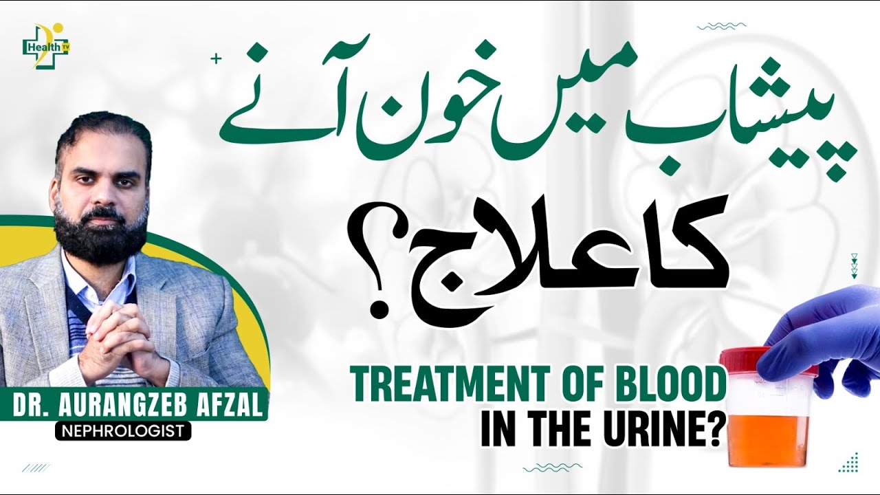 Blood In Urine Treatment | Peshab Mein Khoon Aane Ka Ilaj | Hematuria Reasons In Urdu/Hindi