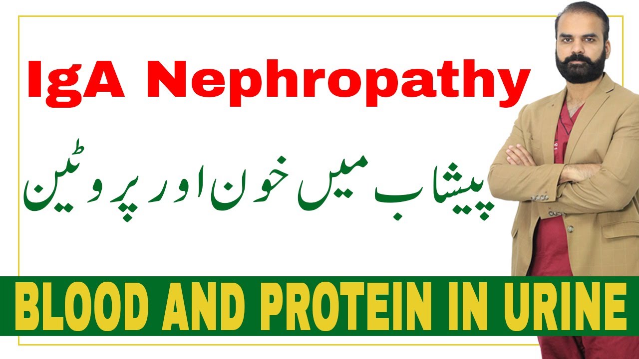 Blood and Protein in urine | ?IgA Nephropathy in Urdu/Hindi?